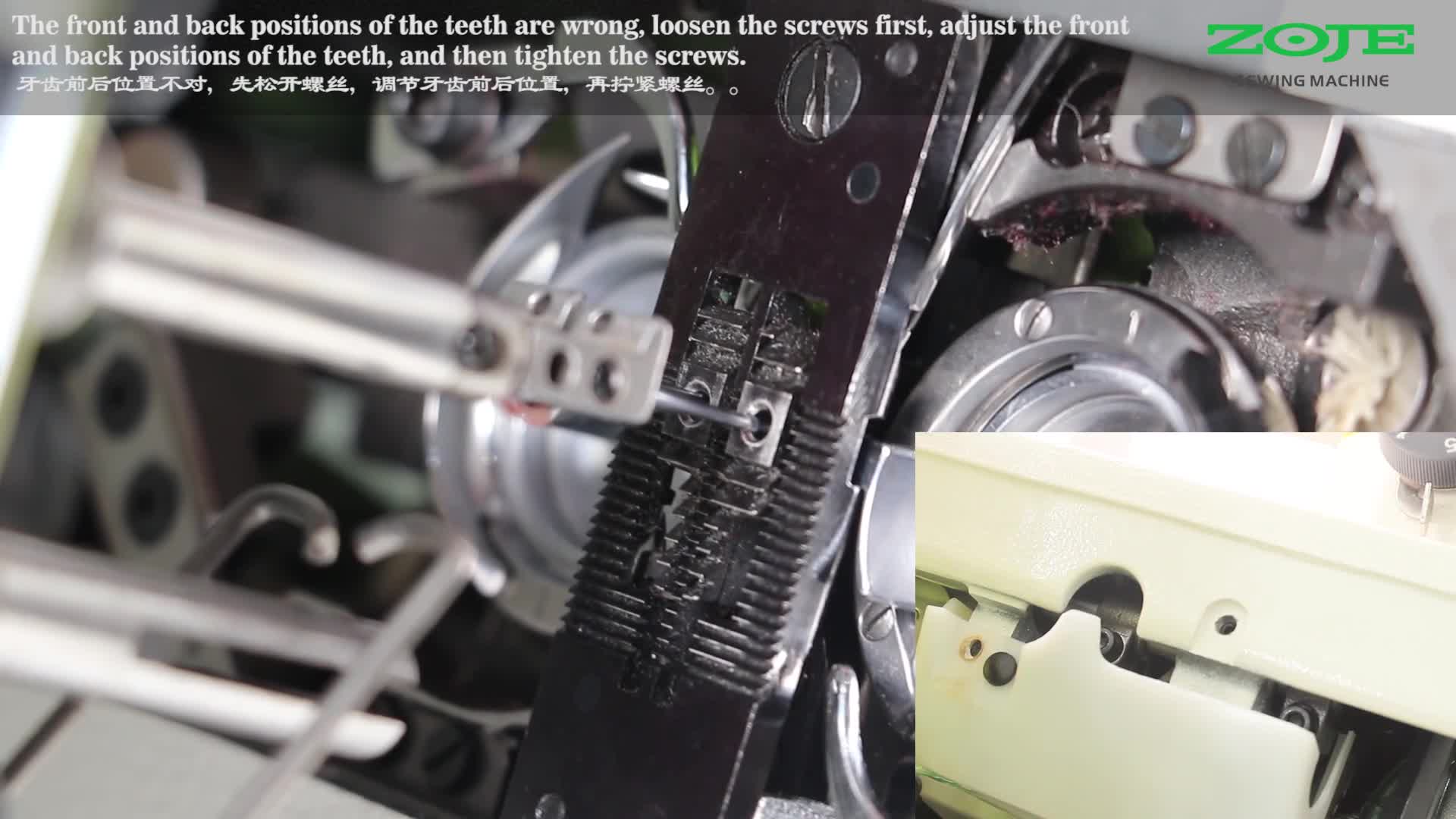 牙齒前后位置調(diào)整