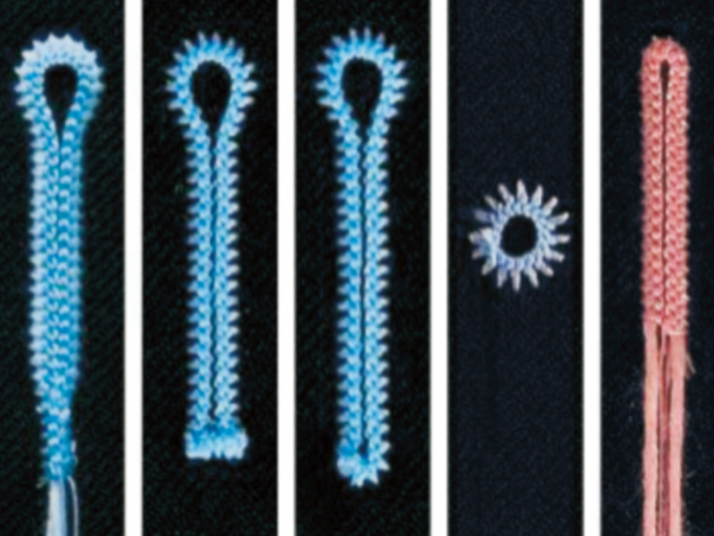 Closed-Loop System Improves Pattern Accuracy and Aesthetics